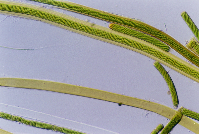 Filamentos de cianobacteria. Foto: Wikimedia Commons.